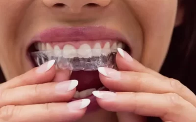 Invisalign Raleigh: Clear Aligner Therapy for Discreet Orthodontic Correction